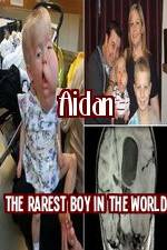 Watch Aidan The Rarest Boy In The World Solarmovie