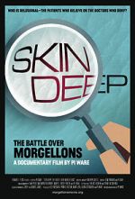 Watch Skin Deep: The Battle Over Morgellons Solarmovie