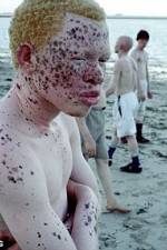Watch Albino United Solarmovie