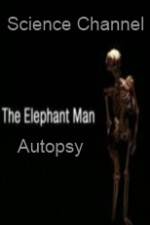 Watch Science Channel Elephant Man Autopsy Solarmovie