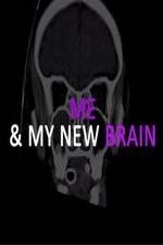 Watch Me & My New Brain Solarmovie