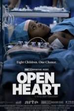 Watch Open Heart Solarmovie