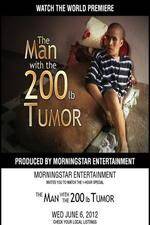 Watch The Man With The 200lb Tumor Solarmovie