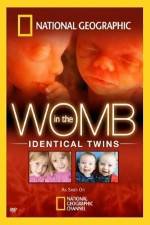 Watch National Geographic: In the Womb - Identical Twins Solarmovie