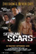 Watch Serbian Scars Solarmovie