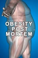 Watch Obesity: The Post Mortem Solarmovie