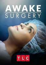 Watch Awake Surgery Solarmovie